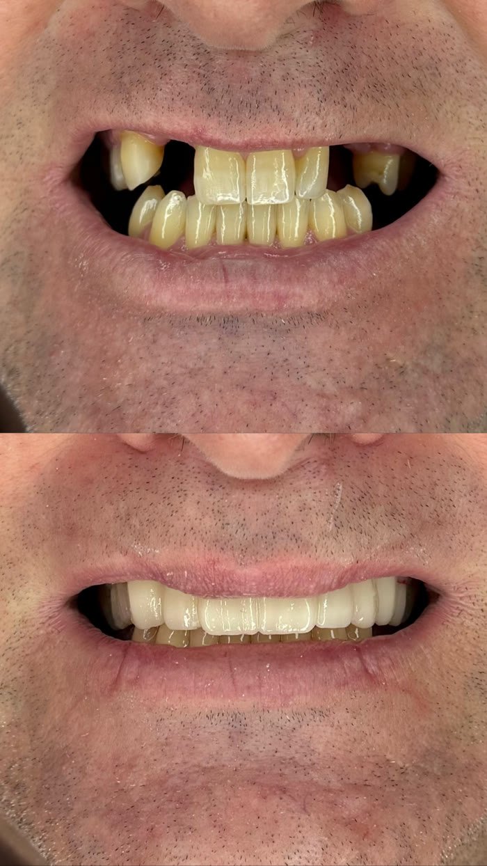 Antes e depois: Múltiplos espaços